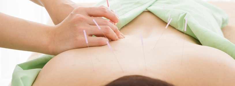 acupuntura-blog