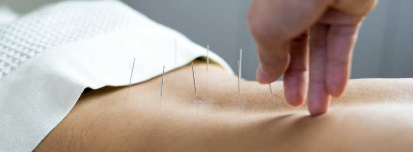 acupuntura-melhor-idade